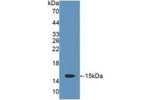 Detection of Recombinant CD7, Rat using Polyclonal Antibody to Cluster Of Differentiation 7 (CD7) (CD7 antibody  (AA 23-128))