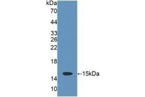 Detection of Recombinant CD7, Rat using Polyclonal Antibody to Cluster Of Differentiation 7 (CD7) (CD7 antibody  (AA 23-128))