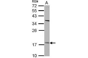 WB Image Sample (30 ug of whole cell lysate) A: H1299 12% SDS PAGE antibody diluted at 1:500 (PNPLA4 antibody)