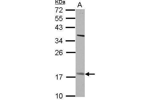 PNPLA4 antibody