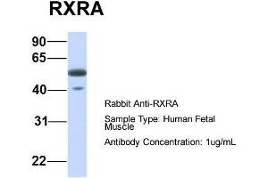 Host:  Rabbit  Target Name:  RXRA  Sample Type:  Human Fetal Muscle  Antibody Dilution:  1. (Retinoid X Receptor alpha antibody  (N-Term))