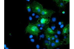 Image no. 9 for anti-FXYD Domain Containing Ion Transport Regulator 3 (FXYD3) antibody (ABIN1498341)