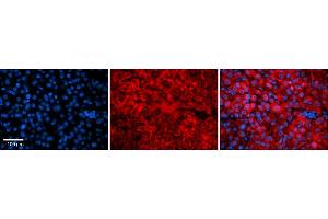 Rabbit Anti-Snf8 Antibody    Formalin Fixed Paraffin Embedded Tissue: Human Adult liver  Observed Staining: Cytoplasmic Primary Antibody Concentration: 1:100 Secondary Antibody: Donkey anti-Rabbit-Cy2/3 Secondary Antibody Concentration: 1:200 Magnification: 20X Exposure Time: 0. (SNF8 antibody  (N-Term))