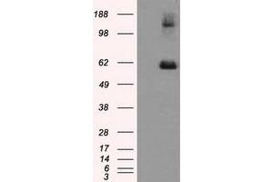 Image no. 1 for anti-Lipase, Endothelial (LIPG) antibody (ABIN1499162) (LIPG antibody)