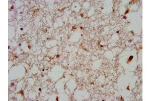 IHC image of ABIN7165031 diluted at 1:600 and staining in paraffin-embedded human brain tissue performed on a Leica BondTM system. (GNAS antibody  (AA 310-404))