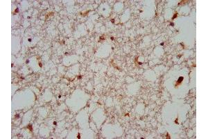 IHC image of ABIN7165031 diluted at 1:600 and staining in paraffin-embedded human brain tissue performed on a Leica BondTM system.