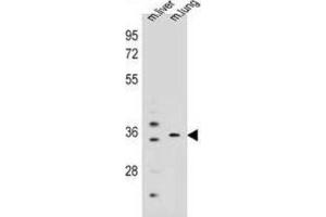 Western Blotting (WB) image for anti-Potassium Channel Regulator (KCNRG) antibody (ABIN2995148) (KCNRG antibody)