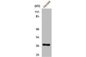 Western Blot analysis of Colo205 cells using OTUB2 Polyclonal Antibody (OTUB2 antibody  (Internal Region))