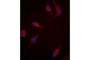 Immunofluorescent analysis of RRAD staining in HepG2 cells. (RRAD antibody  (Center))
