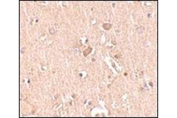 MED28 antibody  (Center)