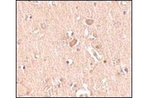 Immunohistochemistry of MED28 in human brain tissue with this product at 2. (MED28 antibody  (Center))