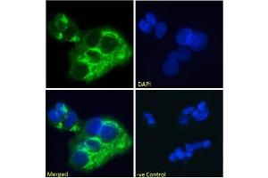 Immunofluoresence staining of fixed HepG2 cells with anti-Alpha-fetoprotein (AFP) antibody AF5. (Recombinant alpha Fetoprotein antibody)