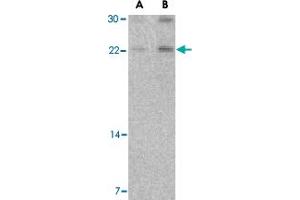 Western blot analysis of CBLN1 in mouse cerebellum tissue lysate with CBLN1 polyclonal antibody  at (A) 2 and (B) 4 ug/mL . (CBLN1 antibody  (Internal Region))