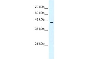 Western Blotting (WB) image for anti-GLIS Family Zinc Finger 3 (GLIS3) antibody (ABIN2461993) (GLIS3 antibody)