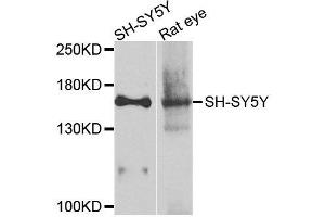 Western blot analysis of extracts of various cell lines, using ADCY2 antibody (ABIN6003537) at 1/1000 dilution. (ADCY2 antibody)