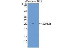 Western blot analysis of the recombinant protein. (Cytokeratin 18 antibody  (AA 1-159))
