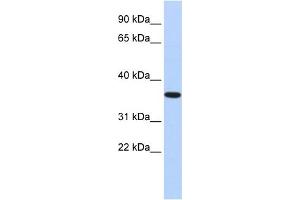 WB Suggested Anti-CPXCR1 Antibody Titration: 1 ug/ml Positive Control: Fetal Brain Lysate (CPXCR1 antibody  (Middle Region))