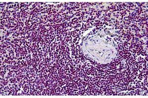 Human Spleen: Formalin-Fixed, Paraffin-Embedded (FFPE) (CDK6 antibody  (AA 3-100))
