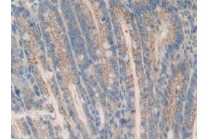 DAB staining on IHC-P; Samples: Mouse Intestine Tissue (MCL-1 antibody  (AA 2-307))