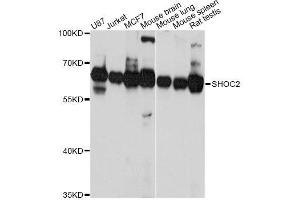 Western blot analysis of extracts of various cell lines, using SHOC2 Antibody. (SHoc2/Sur8 antibody  (AA 1-280))