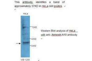 Image no. 1 for anti-Annexin A10 (ANXA10) antibody (ABIN790818) (Annexin a10 antibody)