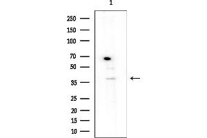 anti-serpin Peptidase Inhibitor, Clade B (Ovalbumin), Member 9 (SERPINB9) (Internal Region) antibody