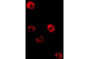 Immunofluorescent analysis of Tropomyosin 3 staining in Hela cells. (TPM3 antibody)