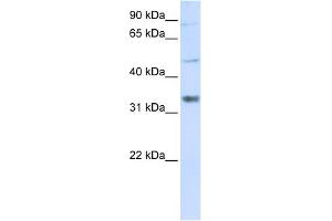 WB Suggested Anti-ZCCHC17 Antibody Titration:  0. (ZCCHC17 antibody  (Middle Region))