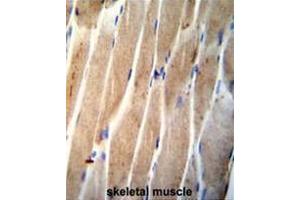 CLEC4F Antibody (C-term) immunohistochemistry analysis in formalin fixed and paraffin embedded human skeletal muscle followed by peroxidase conjugation of the secondary antibody and DAB staining. (CLEC4F antibody  (C-Term))