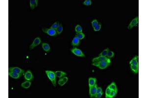 Immunofluorescent analysis of HepG2 cells using ABIN7159734 at dilution of 1:100 and Alexa Fluor 488-congugated AffiniPure Goat Anti-Rabbit IgG(H+L) (MTTP antibody  (AA 19-151))