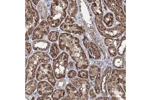 Immunohistochemical staining of human kidney with ACTR6 polyclonal antibody  shows strong cytoplasmic positivity in renal tubules. (ACTR6 antibody)