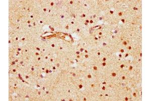 IHC image of ABIN7145804 diluted at 1:600 and staining in paraffin-embedded human brain tissue performed on a Leica BondTM system. (BRD1 antibody  (AA 756-879))