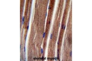 THUM3 Antibody (Center) immunohistochemistry analysis in formalin fixed and paraffin embedded human skeletal muscle followed by peroxidase conjugation of the secondary antibody and DAB staining. (THUMPD3 antibody  (Middle Region))