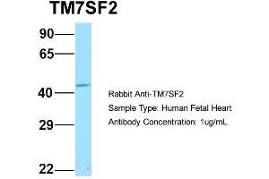 Host: Rabbit Target Name: TM7SF2 Sample Type: Human Fetal Heart Antibody Dilution: 1. (TM7SF2 antibody  (N-Term))