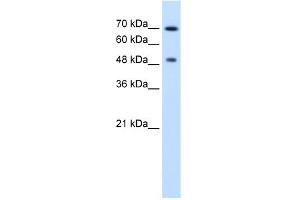 WB Suggested Anti-RAD23A Antibody Titration:  2. (RAD23A antibody  (N-Term))