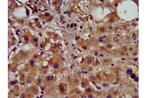 IHC image of ABIN7148955 diluted at 1:600 and staining in paraffin-embedded human liver tissue performed on a Leica BondTM system. (Cyclin Y antibody  (AA 2-170))