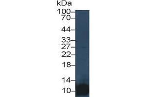 Mouse Capture antibody from the kit in WB with Positive Control:  Human Placenta lysate.