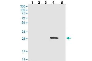 Western blot analysis of Lane 1: RT-4, Lane 2: U-251 MG, Lane 3: Human Plasma, Lane 4: Liver, Lane 5: Tonsil with DULLARD polyclonal antibody . (CTDNEP1A antibody)