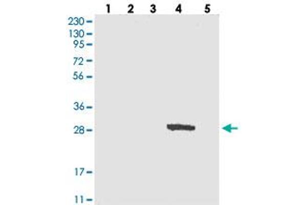 CTDNEP1A antibody