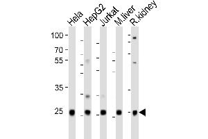 Western blot analysis of lysates from Hela, HepG2, Jurkat cell line, mouse liver, rat kidney tissue(from left to right), using UBB(Ubiquitin) Antibody (N-term) (ABIN6242685 and ABIN6577623).