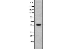 Western blot analysis of CA10 using HuvEc whole cell lysates