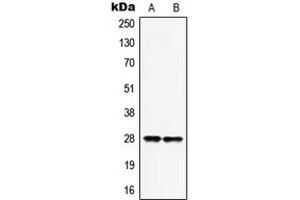 Western blot analysis of HOXB9 expression in MCF7 (A), HepG2 (B) whole cell lysates. (HOXB9 antibody  (C-Term))