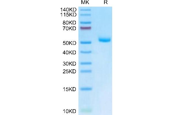 MPZL2 Protein (AA 27-154) (Fc Tag)