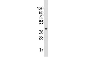 Western blot analysis of ALDOA antibody and mouse liver tissue lysate. (ALDOA antibody  (AA 303-331))