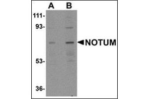 Western blot analysis of NOTUM AP30609PU-N antibody in Human kidney tissue lysate at 0. (NOTUM antibody  (N-Term))