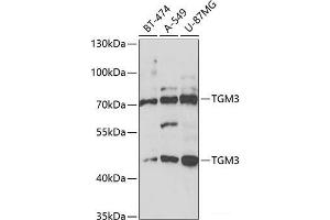 Western blot analysis of extracts of various cell lines using TGM3 Polyclonal Antibody at dilution of 1:1000.