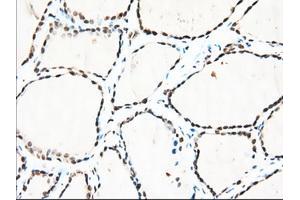 Immunohistochemical staining of paraffin-embedded Human lung tissue using anti-TACC3 mouse monoclonal antibody.