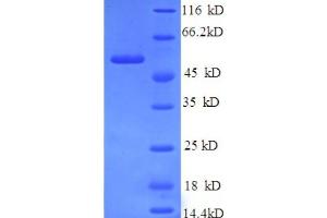 SDS-PAGE (SDS) image for NCAP (AA 1-498), (full length) protein (His tag) (ABIN5711219) (NCAP (AA 1-498), (full length) protein (His tag))