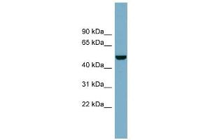 CSF1 antibody used at 1 ug/ml to detect target protein.
