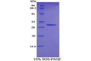 SDS-PAGE (SDS) image for Angiopoietin 2 (ANGPT2) (AA 269-496) protein (His tag) (ABIN1169866)
